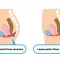Is a Pelvic Floor Disorder Program in Demand?